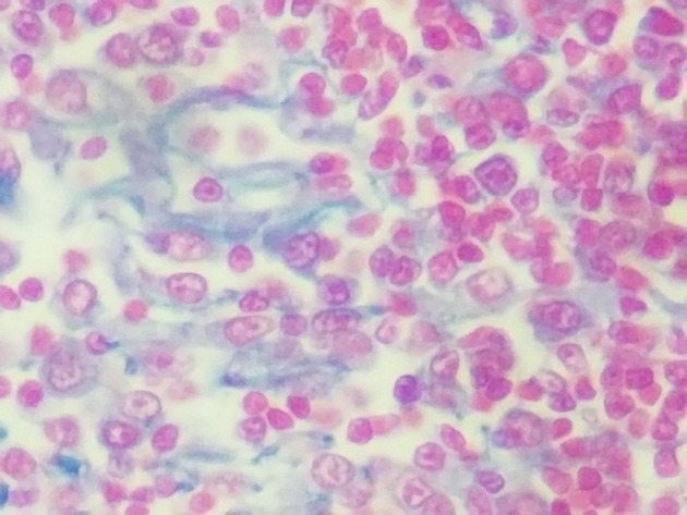Reticular Connective Slides - Reticular Connective 01 400X